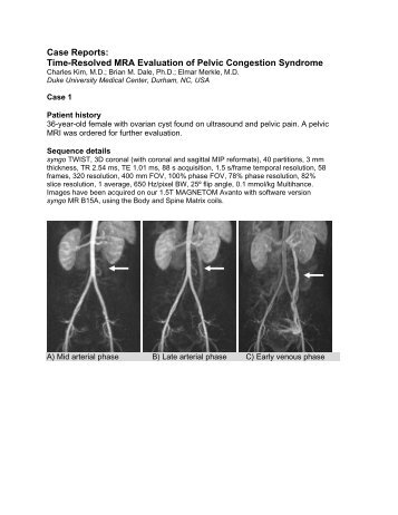 Sweet! Geil Pelvic congestion orgasm final